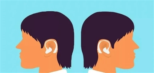 双耳佩戴助听器可预防听觉剥夺现象